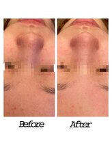 アクアプラス(AQUA+)/ハイドロスプラッシュ30代女性