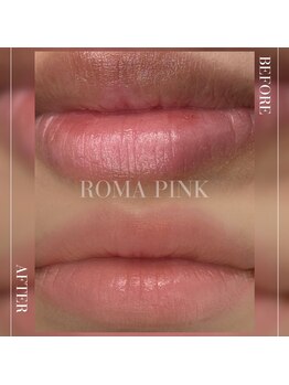 ヒメミ(Himemi)/★ローマピンク★