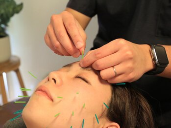 ハリング(HARIING)