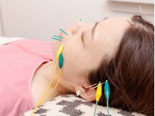アルト(alto)の雰囲気（人気の美容鍼はaltoならではの選べる美容鍼。噛みしめ・頭痛にも）