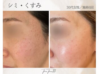 スリースリー(THREE THREE)/シミ・くすみケア