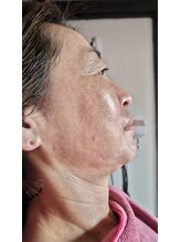 ミホズルーム(Miho‘s room)/フェイシャル