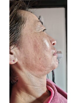 ミホズルーム(Miho‘s room)/フェイシャル