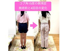 エスコート芦屋サロンの雰囲気(猫背は発育に影響します。子供の猫背は一生の問題です)