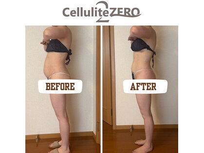 メリッサ(Melissa)の写真