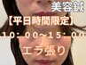 【平日10時～15時限定】エラで顔の大きさが気になる方に♪（美容鍼＋EMS機械)
