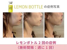 アメリイ 百合ヶ丘 新百合ヶ丘(Amerii)/【50代レモンボトル】2回の結果