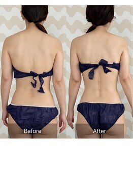 トリムリターン 三重伊賀店Mana/呼吸が深く楽に。肩こりも解消