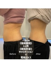 キレピア 熊本インター店(kirepia)/年末に向けて♪痩身無料体験