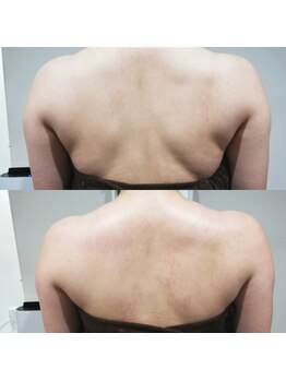 RiとBiのたまご/（ブライダル）お試し