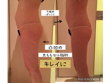 ビューティースパ/ポッコリお腹/凸凹セル脂肪改善!