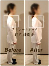 ティーエスエル とがし整体ラボ(TSL とがし整体 Labo)/姿勢矯正・猫背 巻き肩/美容整体