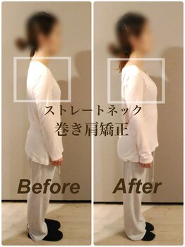 ティーエスエル とがし整体ラボ(TSL とがし整体 Labo)/姿勢矯正・猫背 巻き肩/美容整体