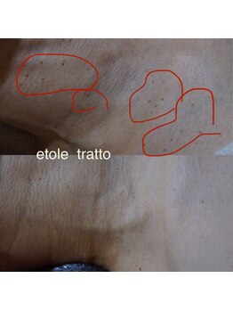 ザ シー タイムレスビューティ(THE SHE)/50代お客様症例写真