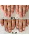 最強のネイルケア3ヶ月コース
