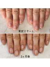 ネイルズ アヴァンティ(Nails Avanti)/最強のネイルケア3ヶ月コース