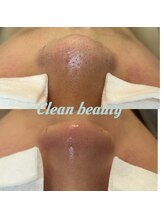 クリーン&ビューティー/毛穴洗浄／毛穴の黒ずみ／美肌 