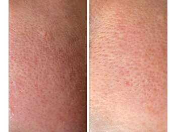 サイ(Sai)/before⇒after