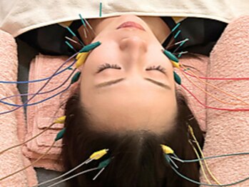 ハーモニー(Harmony)の写真/【小顔ケアなら美容鍼☆】国家資格鍼灸師による施術で、理想のフェイスラインへ。