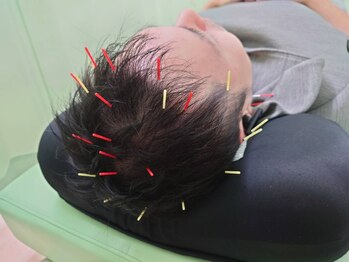 アスミルはり灸接骨院/