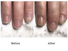 アンベリール(embellir.)/自爪・深爪育成