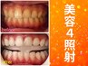 【会員／回数券】8分×4回美容セルフホワイトニング