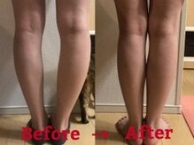 ティーラボ(T-LABO)/２０代女性O脚改善で美脚に