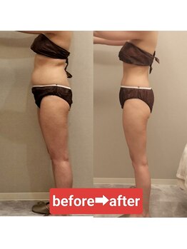 ラブリエ(Labriller)/ウルトラ痩身