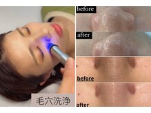 ブルーシー(BLUESEA)の雰囲気（毛穴のお悩みお任せ下さい！）