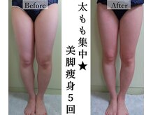ソフィームの雰囲気（ラフォスや脂肪冷却・など多くのマシンを使用し結果を出します。）