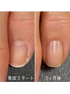 最強のネイルケア3ヶ月コース