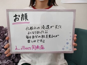 リリアン 周南店(Lillian)/お顔脱毛のお声!