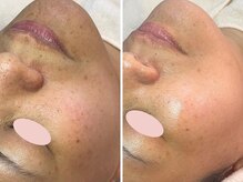 ボーテニスタ(BEAUTE NISTA)