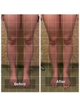 リンパケア顔筋美容のフフ(ff)/