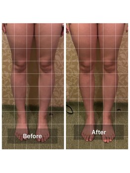 リンパケア顔筋美容のフフ(ff)/