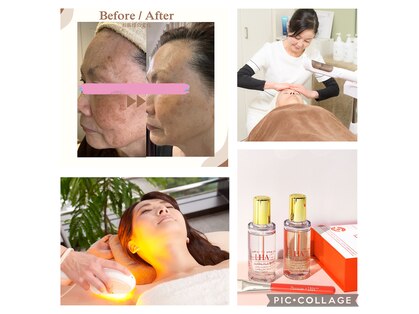 プアラニ フォレストの写真