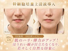 エターナル(Eternal)