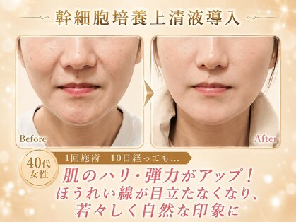 エターナル(Eternal)の写真