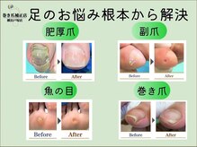 巻き爪補正店 横浜戸塚店