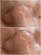 リノ(Lino)の写真/【大人女性の毛穴大掃除】ポツポツ黒ずみ・角栓を徹底洗浄+引き締め保湿!触りたくなるツルツル素肌に