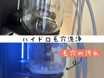 ルミア 熊本帯山店(LUMIA)の写真/気になる毛穴の汚れをしっかりと落とします♪ハイドロピーリングで新鮮な水素と美容液の贅沢なケアを体験◎