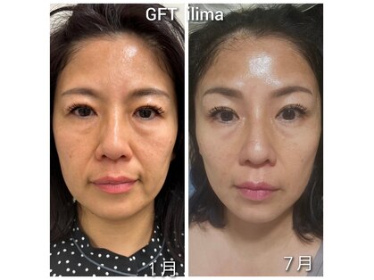 イリマ(Ilima)の写真