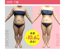 シェアラ 名古屋サカエ店の雰囲気（高技術の施術で結果が嬉しい！あなたに合わせた最適プランを☆）