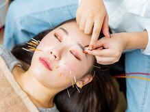 ハリナチュレ 南流山店/美容鍼♪