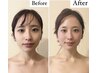 小顔【たるみアップ】顔の骨格筋膜リリース＆マシンで2周り小さく！60分
