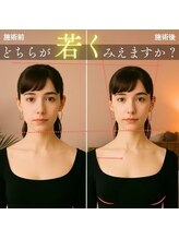 美座ノ女 梅田 淀屋橋本店&nbsp;施術前後 （正面）