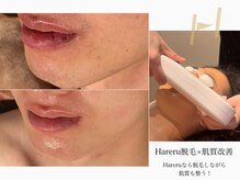 ハレル ビューティーサロン(Hareru beauty salon)の雰囲気（Hareru脱毛×肌質改善）