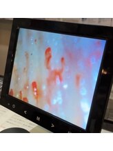 最終形美/毛細血管の状態をみてみましょう