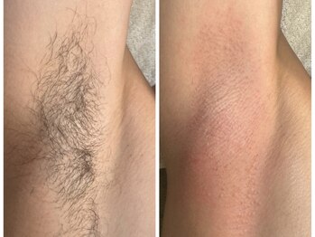 ティーダグー(Tiida guu)/ワックスでこんなにツルツル!