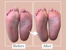 ベベ(Bebe)/20代女性/ガサガサお悩み